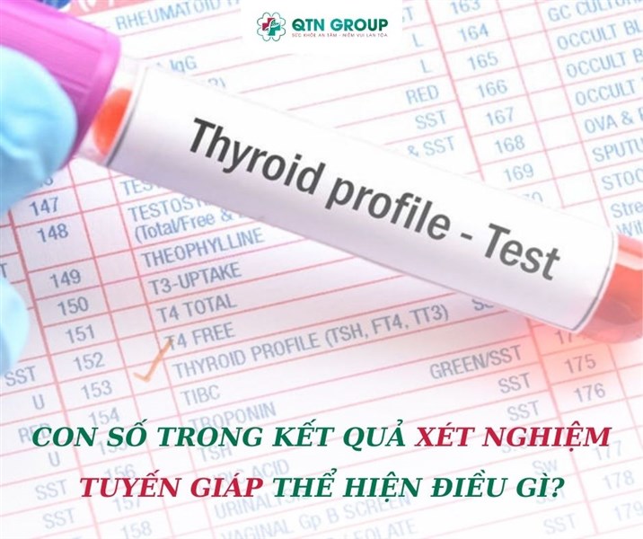 CON SỐ TRONG KẾT QUẢ XÉT NGHIỆM TUYẾN GIÁP THỂ HIỆN ĐIỀU GÌ?