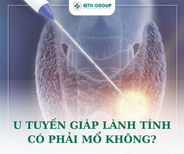 U tuyến giáp lành tính có cần mổ không?