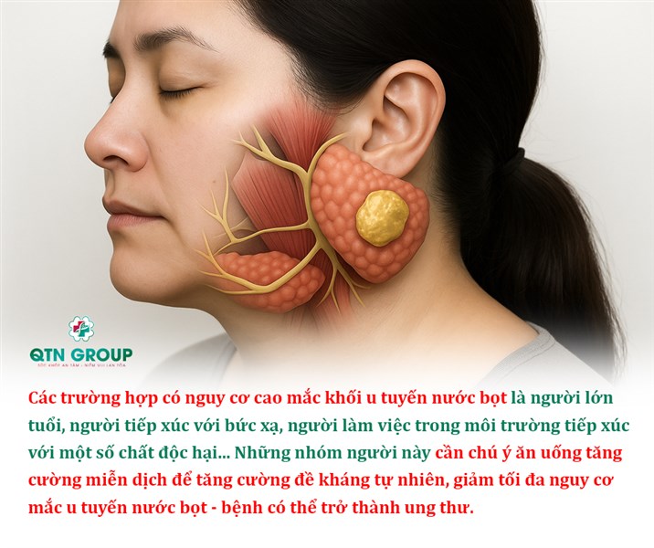 U tuyến nước bọt: Nguyên nhân gây bệnh và những đối tượng dễ mắc