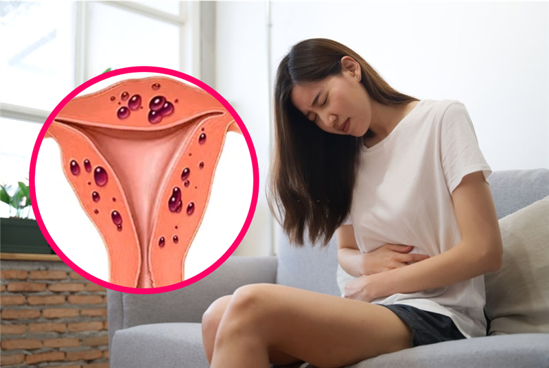 Bị lạc nội mạc tử cung có uống thuốc giảm cân được không?