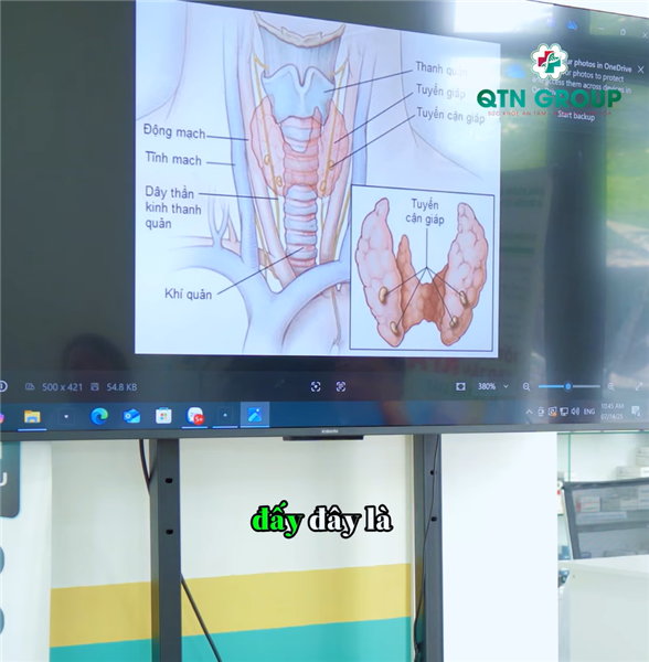 Vị trí u tuyến giáp hình thành: Vì sao bệnh nhân có thể bị khàn tiếng sau điều trị?