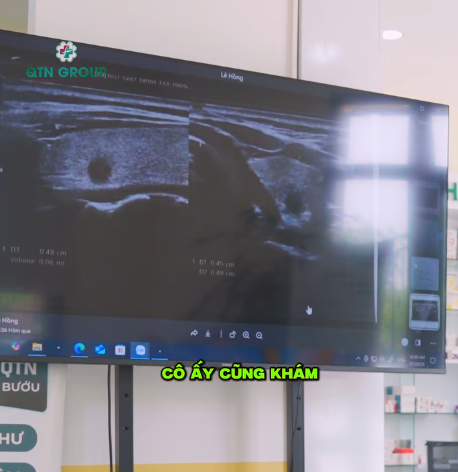 Nhận biết u lành hay u ác qua màn hình phóng to cùng BS Thái