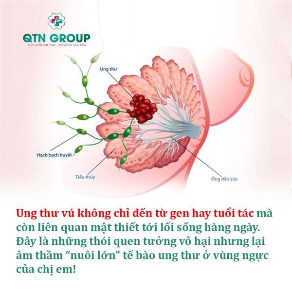 Những thói quen hàng ngày làm tăng nguy cơ ung thư vú nhiều người bỏ qua
