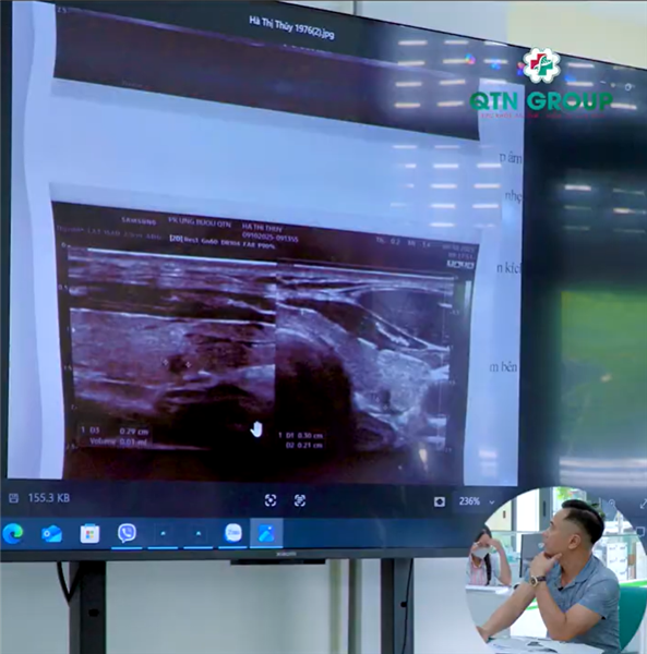 "Nhân này sẽ nghiêng về ung thư"