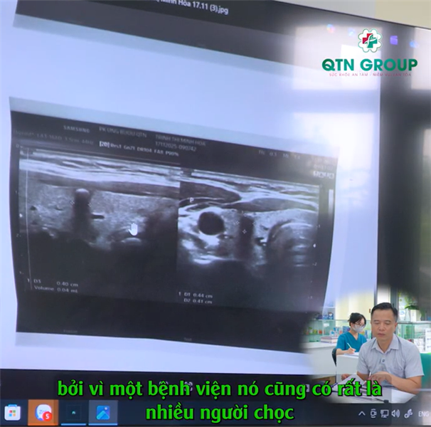 Bác sĩ nói nhân tuyến giáp hơi xấu: Xử lý thế nào?