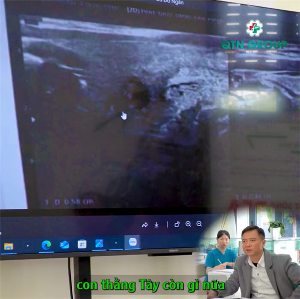 "Này ung thư rồi"...