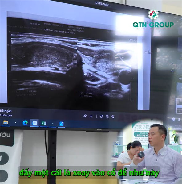 Vì sao BS Thái nhận định đây là u tuyến giáp bất thường?