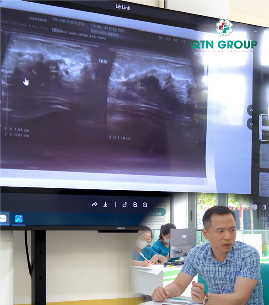 Hình ảnh siêu âm cho thấy nhân ung thư