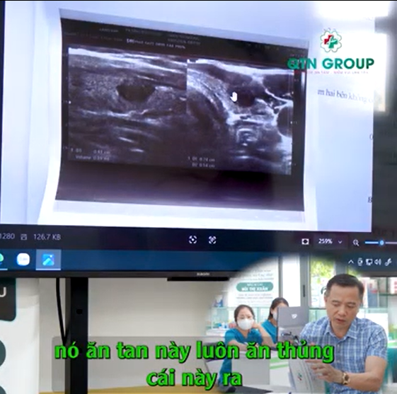 "Cái nhân này có vấn đề rồi"...