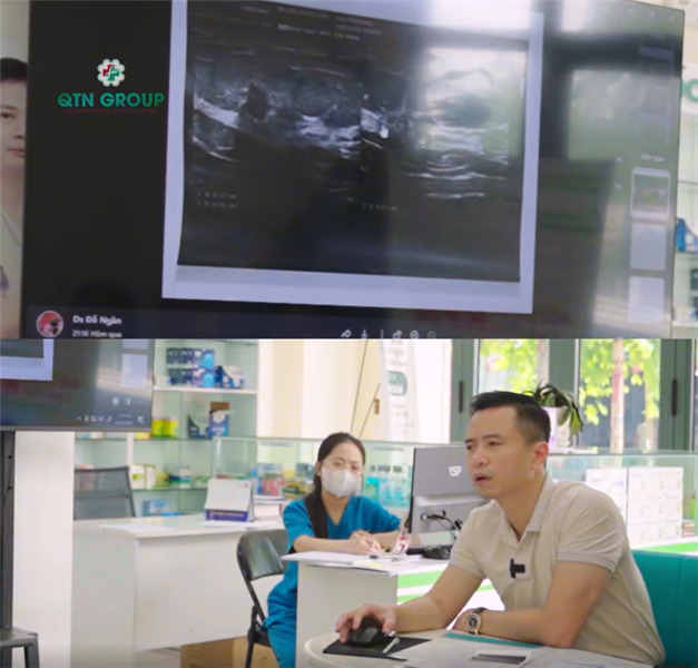 U vú bé vẫn phát hiện ung thư