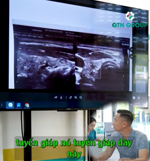 "Không còn mạch nuôi" - Điều bệnh nhân tái khám RFA mong đợi nhất