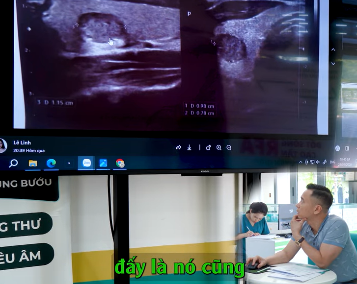 Nhân tuyến giáp hơi giảm âm, BS Nguyễn Văn Thái đã nhận ra ung thư