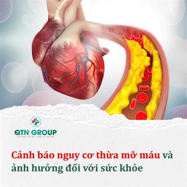 Mỡ máu cao và những hệ lụy sức khỏe khó lường