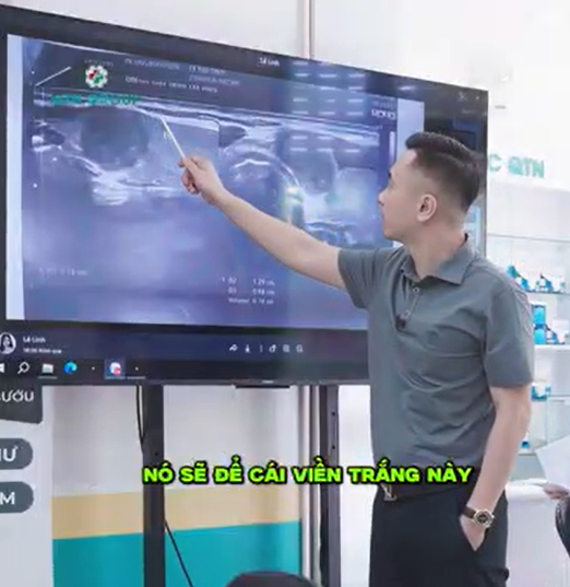 Bệnh nhân bị ung thư tuyến giáp nhưng nơi khác bảo lành tính