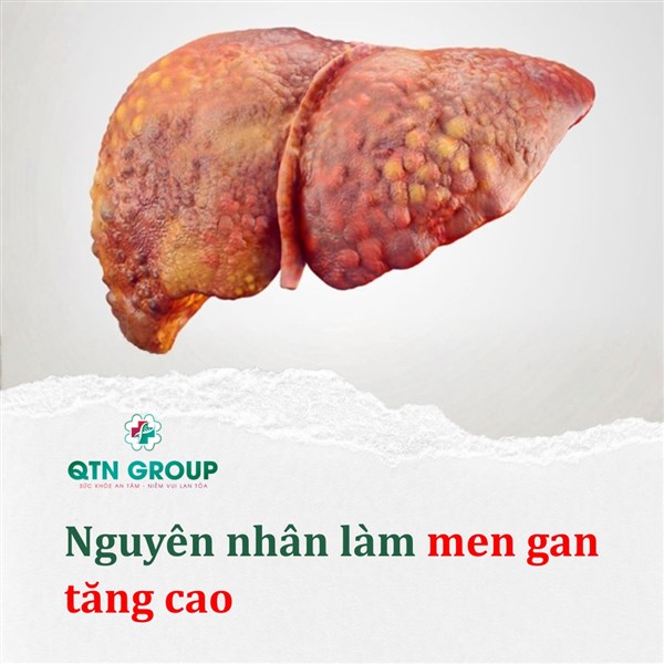 Men gan cao do đâu?