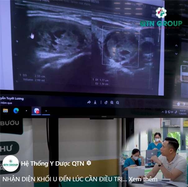 Nhận diện khối u đã đến lúc cần điều trị