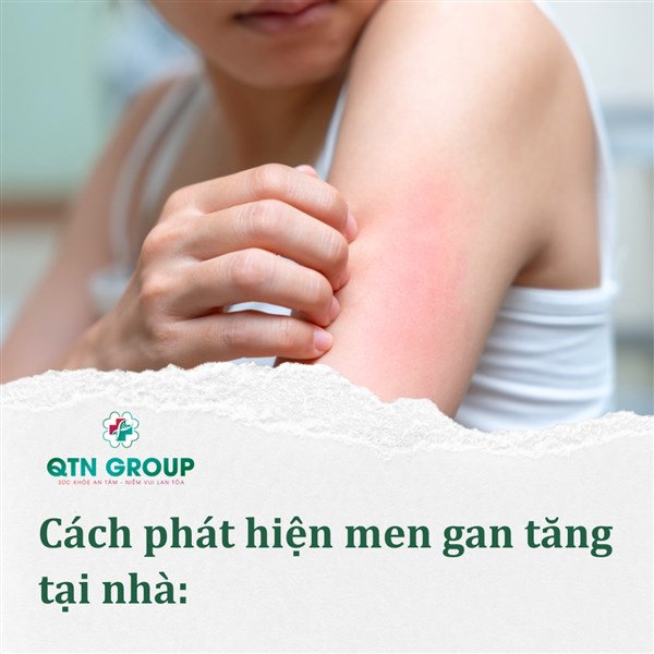 Dấu hiệu nhận biết men gan tăng qua màu da