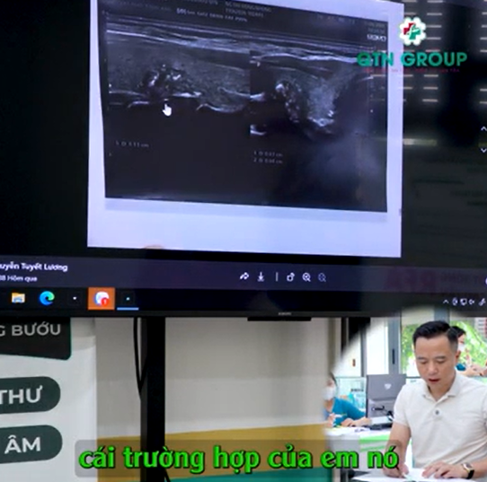 "Cái này rõ ràng quá! Ung thư rồi"