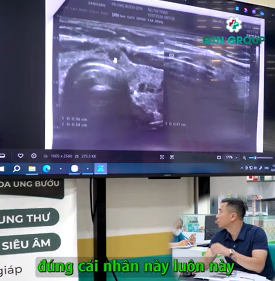 Phân biệt u lành và u ác qua hình ảnh siêu âm