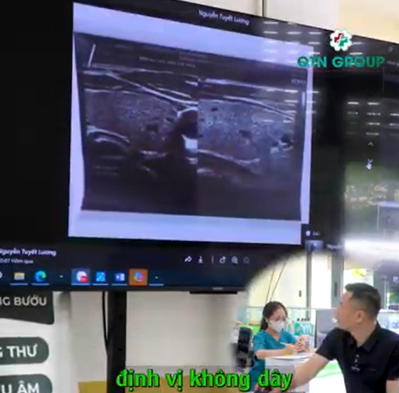 Tư vấn cho bệnh nhân nữ có 2 nhân vú "không tốt lắm"