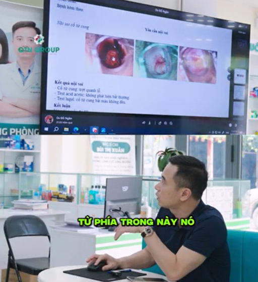 Mới viêm lộ tuyến độ 1 đã bị ung thư cổ tử cung