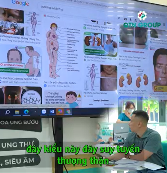 Khuôn mặt của người bị hội chứng cushing