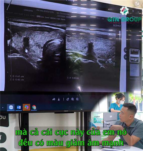 "Nhân này làm sao mà thoát được?"