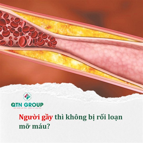 Người gầy thì khỏi lo bệnh mỡ máu?