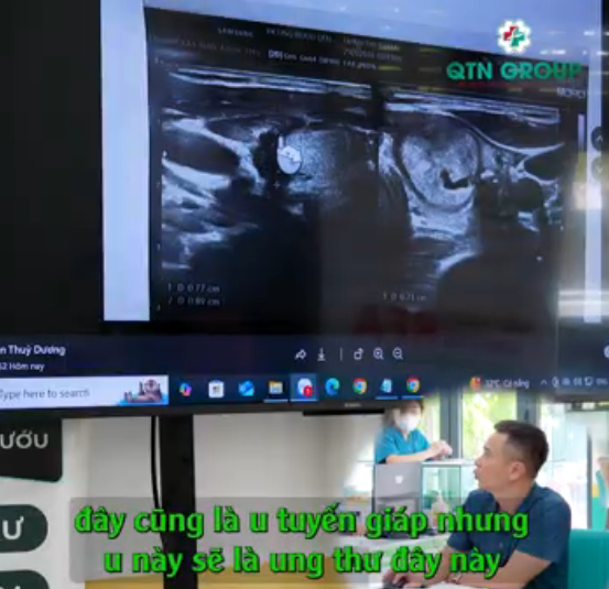Ung thư tuyến giáp nhưng nơi khác chẩn đoán lành tính