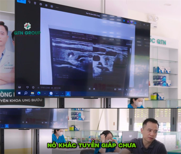 "Tuyến giáp của chị có nang chứ không phải nhân"